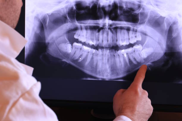 Best Emergency Root Canal Treatment in Greentree, NJ