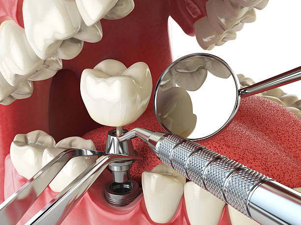 Best Mobile Emergency Dentist in Greentree, NJ